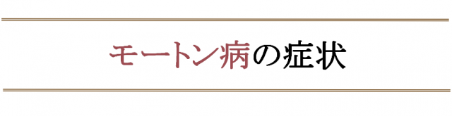 モートン病の症状