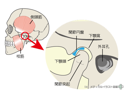 口 を 開ける と 顎 が 鳴る