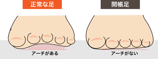 足の指の付け根が痛いのはモートン病かもしれません 南浦和の整体 巡り整体院 口コミno 1で雑誌にも掲載