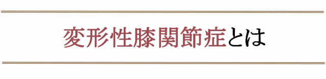 変形性膝関節症になったら気を付ける事