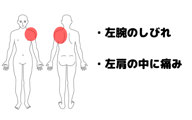 頸椎ヘルニアの症例 姿勢によって左肩に痛みやしびれが出る症例 南浦和の整体 巡り整体院 口コミno 1で雑誌にも掲載